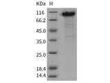 Recombinant Rat TIM1/HACVR1 Protein (His & Fc Tag)