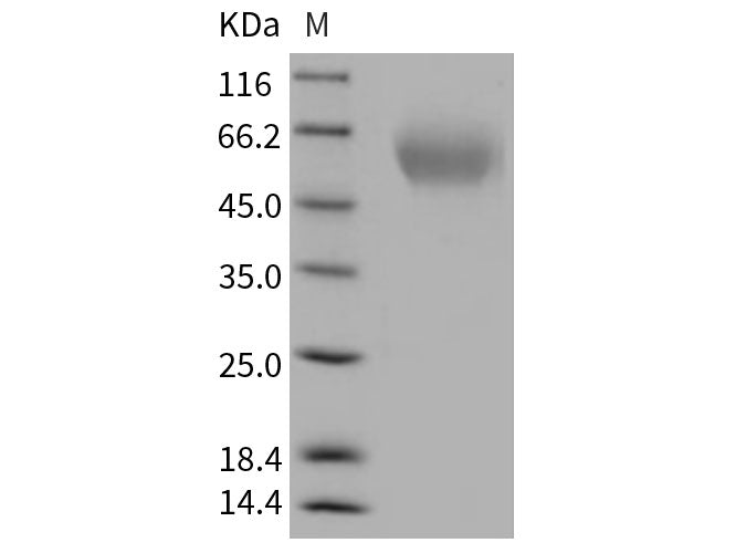 Recombinant Rat TIM1/HACVR1 Protein (His Tag)