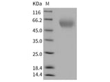 Recombinant Rat TIM1/HACVR1 Protein (His Tag)