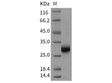 Recombinant Rat TIMP-1/TIMP1 Protein (Active)