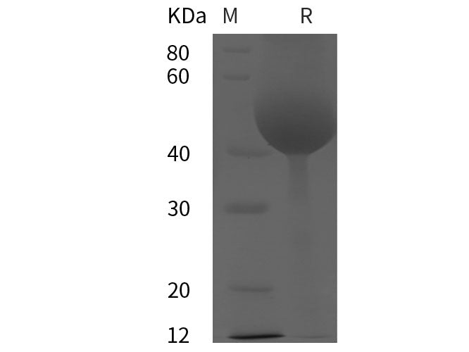 Recombinant Rat Tissue factor/TF protein (His tag)