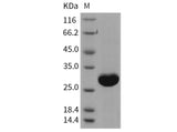 Recombinant Rat UCHL1/PGP9.5 Protein (His Tag)(Active)