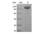 Recombinant Rhesus Macaque Angiopoietin-2/ANG2 (C-Fc)