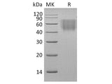 Recombinant Rhesus macaque B7-2/CD86 Protein (His Tag)