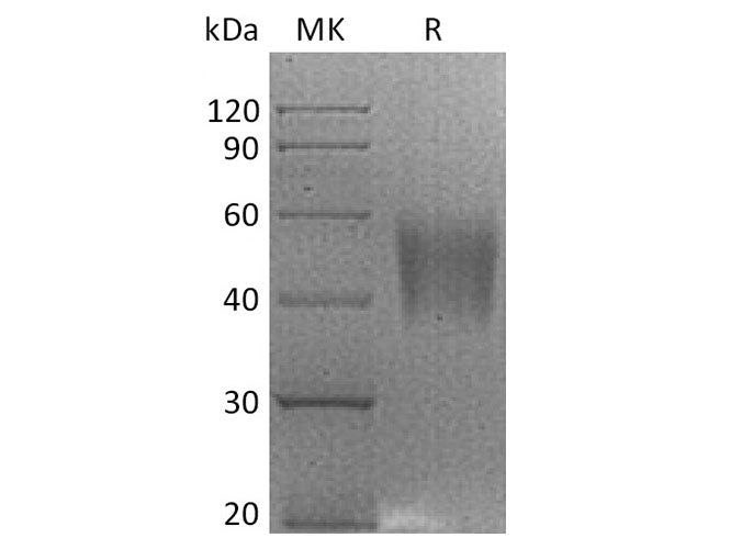 Recombinant Rhesus macaque B7-H4/VTCN1 Protein (His Tag)