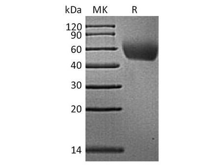Recombinant Rhesus macaque CD155/PVR/NECL5 Protein (His Tag)