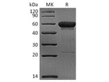 Recombinant Rhesus macaque CD160 Protein (Fc Tag)