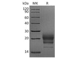 Recombinant Rhesus macaque CD160 Protein (His Tag)