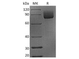 Recombinant Rhesus macaque CD19 Protein (Fc Tag)