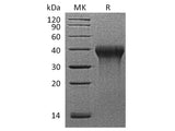 Recombinant Rhesus macaque CD27/TNFRSF7 Protein (His Tag)