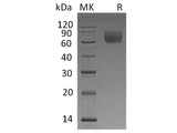 Recombinant Rhesus macaque CD47/IAP Protein (Fc Tag)