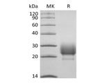 Recombinant Rhesus Macaque CD79B/B29 (C-6His)