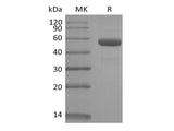 Recombinant Rhesus Macaque CD79B/B29 (C-Fc)