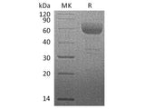 Recombinant Rhesus macaque HVEM/TNFRSF14/CD270 Protein (Fc Tag)