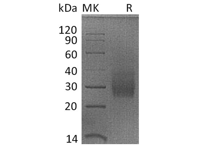 Recombinant Rhesus macaque HVEM/TNFRSF14/CD270 Protein (His Tag)