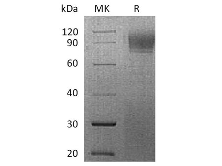 Recombinant Rhesus macaque IFNAR1 Protein (His Tag)