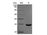 Recombinant Rhesus macaque IL-33/Interleukin-33 Protein (His Tag)