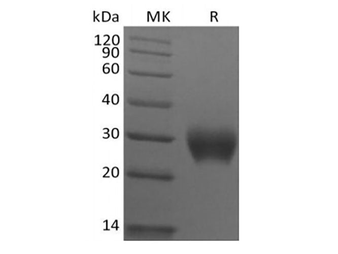 Recombinant Rhesus Macaque Leukocyte-associated Immunoglobulin-like Receptor 1/LAIR1/CD305 (C-6His)