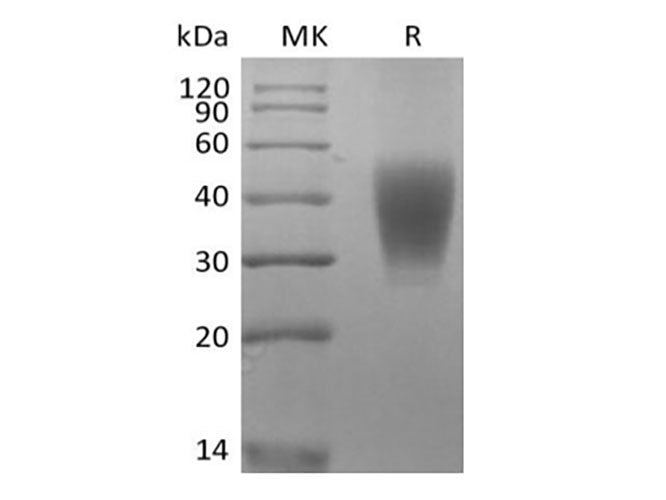 Recombinant Rhesus Macaque SLAM Family Member 7/SLAMF7/CD319/CRACC (C-6His)