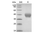 Recombinant Rhesus Macaque TNF Receptor II/TNF RII/TNFRSF1B/CD120b (C-6His)