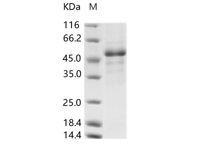 Recombinant Rift Valley fever virus (RVFV) (strain MP12) glycoprotein / G1 Protein (His Tag)