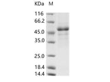 Recombinant Rift Valley fever virus (RVFV) (strain MP12) glycoprotein / G1 Protein (His Tag)