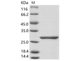 Recombinant Rift Valley fever virus (TAN/Dod-002/07) RVFV-L Protein (His Tag)