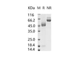 Recombinant RSV (A2) Fusion glycoprotein / RSV-F Protein (His Tag)