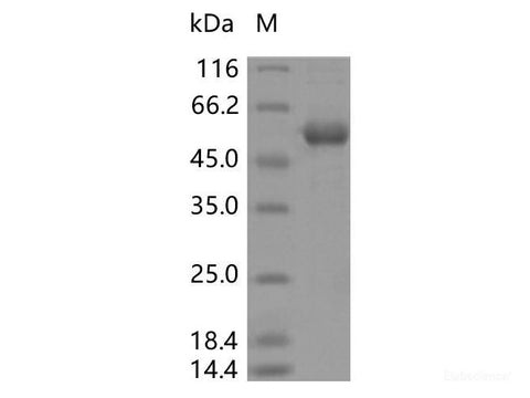 Recombinant SARS-CoV-2 N Protein (T205I)(His Tag)
