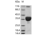 Recombinant SARS-CoV Plpro/papain-like protease (His Tag)