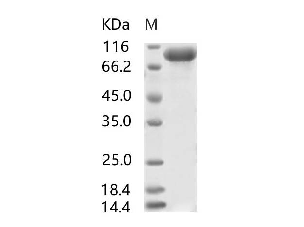 Recombinant SARS-CoV S1 Protein, Biotinylated (His Tag)
