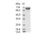 Recombinant SARS-CoV S1 Protein, Biotinylated (His Tag)