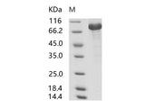Recombinant SARS-CoV S1 Protein (His Tag)（Active）