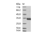 Recombinant SARS-CoV Spike/RBD Protein (RBD, His Tag)