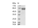 Recombinant SARS-CoV Spike S2-His Recombinant Protein