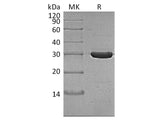 Recombinant Thermobifida fusca Cutinase Protein (His Tag)
