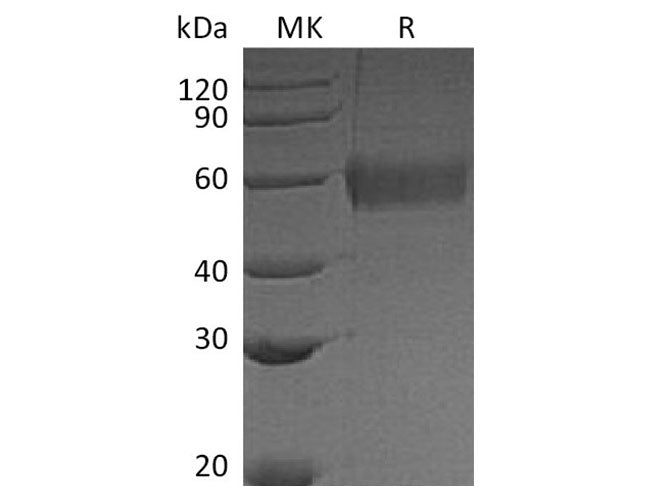 Recombinant Vaccinia virus Soluble Interferon α/β Receptor B18 Protein (His Tag)