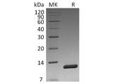 Recombinant Vibrio cholerae Toxin B Protein