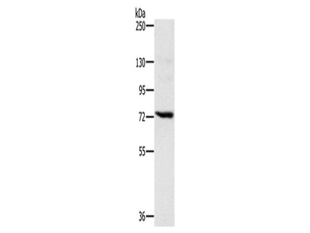 NCSTN Polyclonal Antibody Store at -20°C