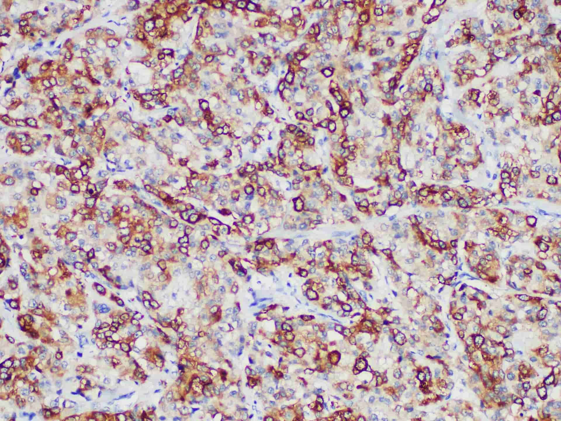 RRM1 Monoclonal Antibody Stored at 2~8°C