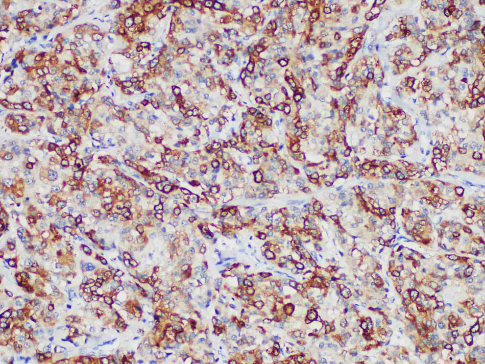 RRM1 Monoclonal Antibody Stored at 2~8°C