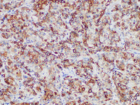 RRM1 Monoclonal Antibody Stored at -20°C