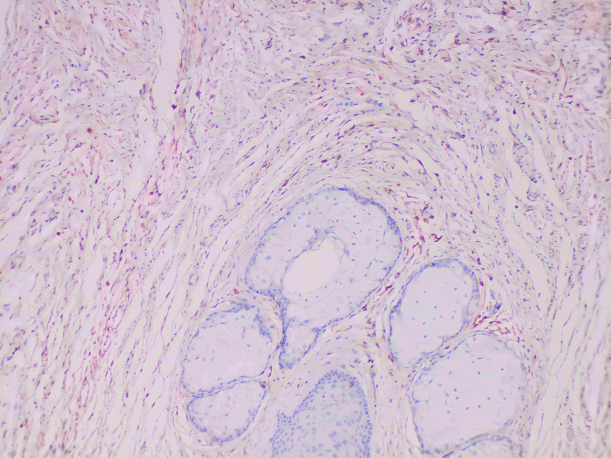 S100A4 Monoclonal Antibody Stored at 2~8°C