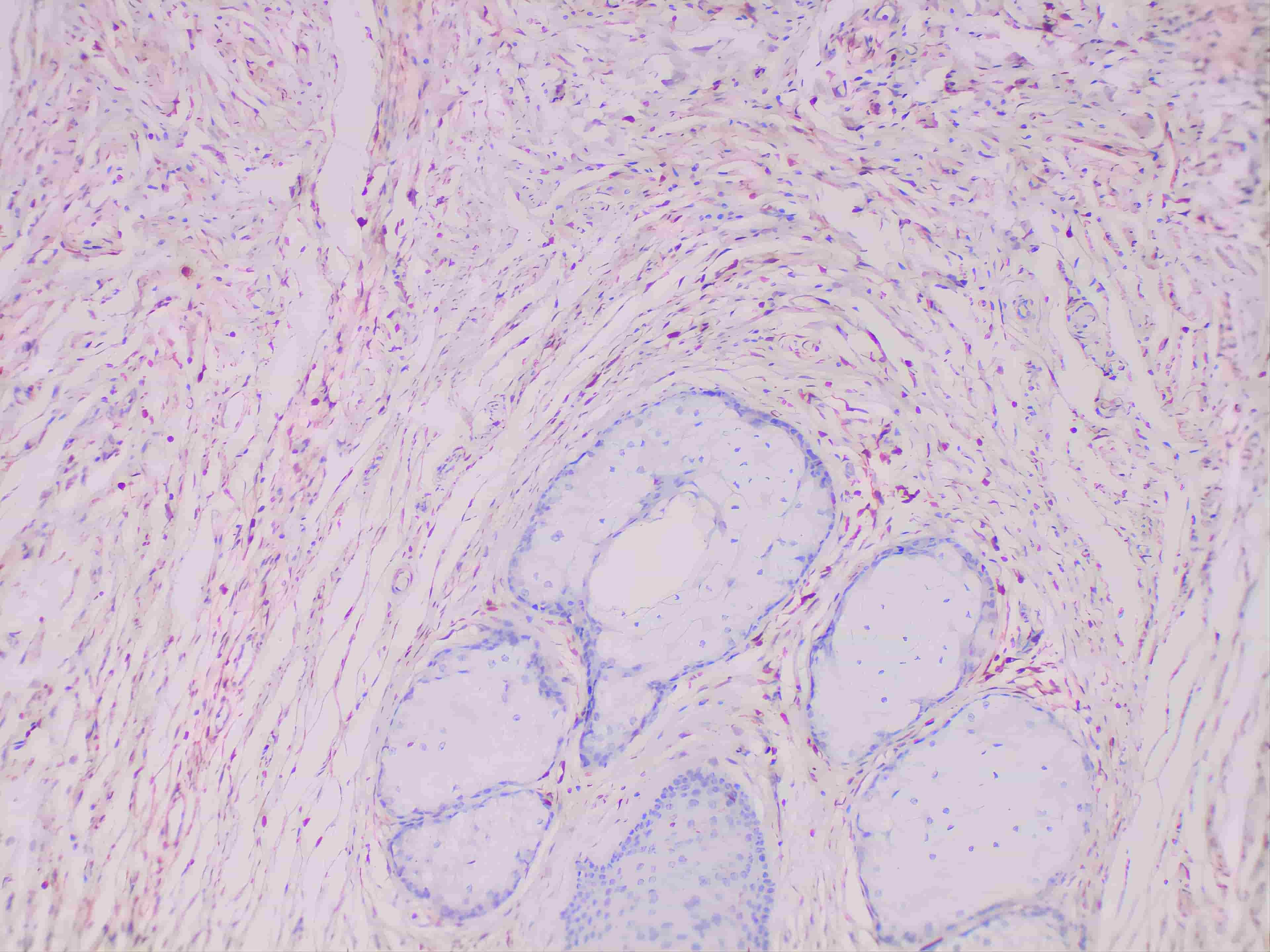 S100A4 Monoclonal Antibody Stored at 2~8°C