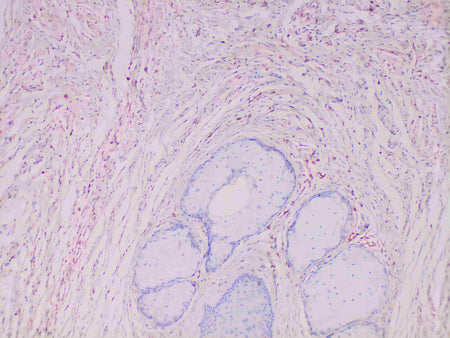 S100A4 Monoclonal Antibody Stored at -20°C
