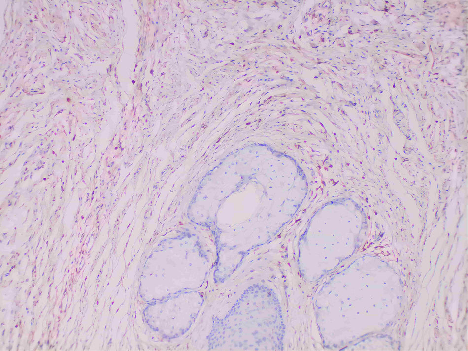 S100A4 Monoclonal Antibody Stored at -20°C