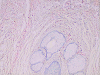 S100A4 Monoclonal Antibody Stored at -20°C