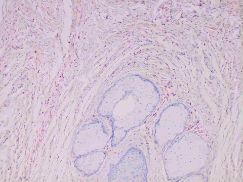 S100A4 Monoclonal Antibody Stored at -20°C