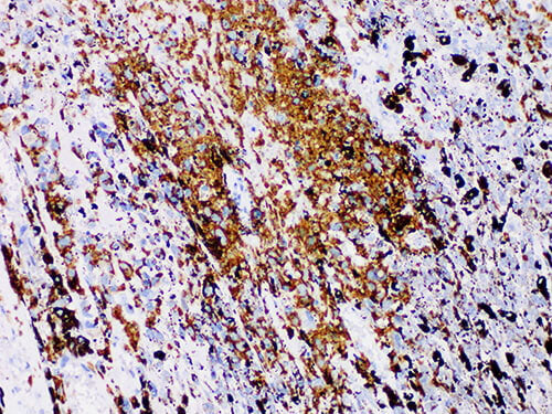 S100P Monoclonal Antibody Stored at 2~8°C