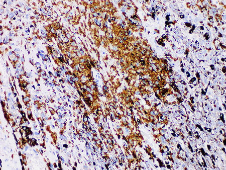 S100P Monoclonal Antibody Stored at 2~8°C